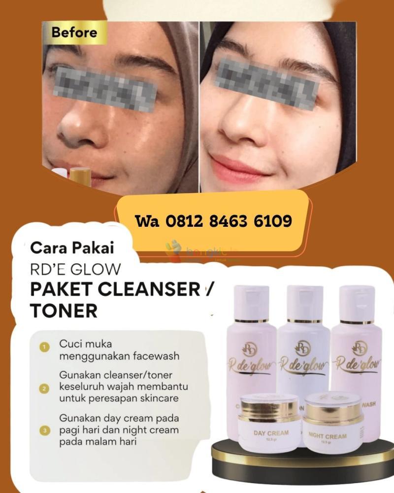 paket skincare rd gold untuk glowing- o8i2-8463-6IO9, Batang-jawa tengah