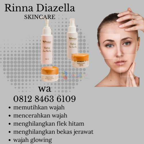 cream rinna diazella untuk bekas jerawat- o8i2-8463-6IO9