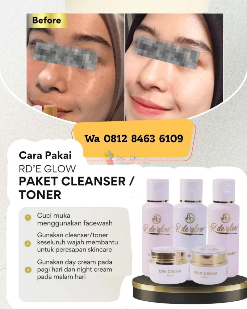 paket rde glow skincare untuk bruntusan-Q8I2-8463-6IO9, Pati-jawa tengah