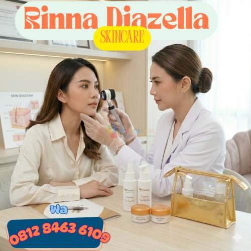 Krim Rinna Diazella atasi kulit berminyak berlebih→O8I284636IO9,Pangandaran